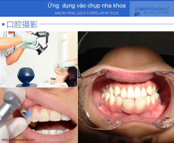 thumbnail Flash Godox ML-150 ring macro - 4